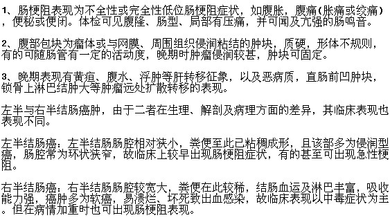 患上結(jié)腸癌會出現(xiàn)哪些癥狀表現(xiàn)？