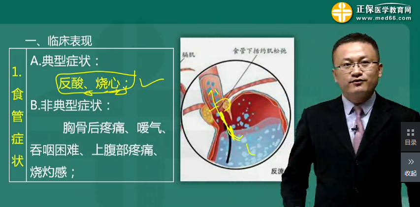 胃食管反流?。℅ERD）的藥物治療方法-消化系統(tǒng)高頻考點(diǎn)