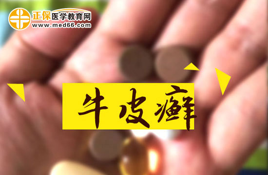 牛皮癬一般有哪些誘發(fā)因素？